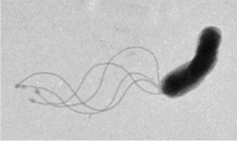 Helicobacter pylori – simptome si test