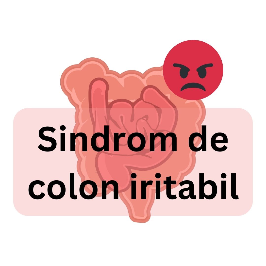 sindrom de colon iritabil